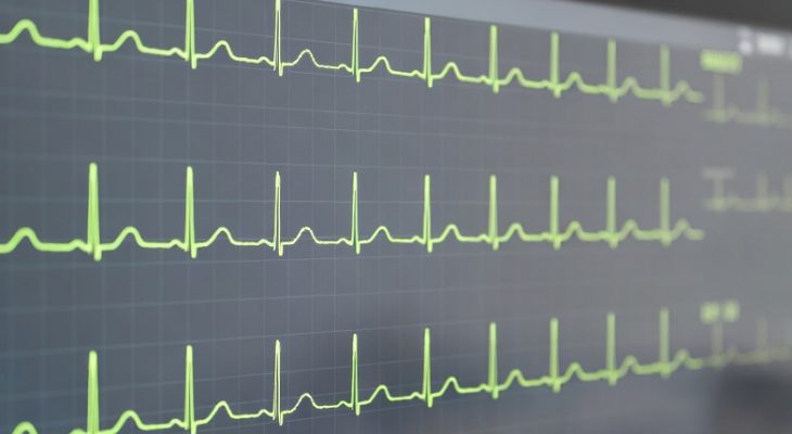 Фибрилляция предсердий. Лечение