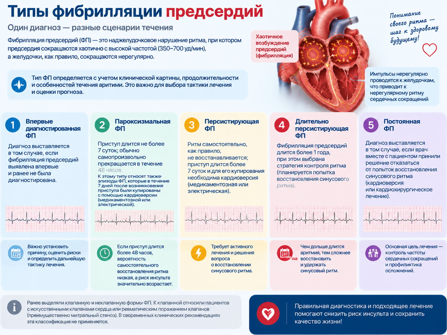 Классификация фибрилляции предсердий